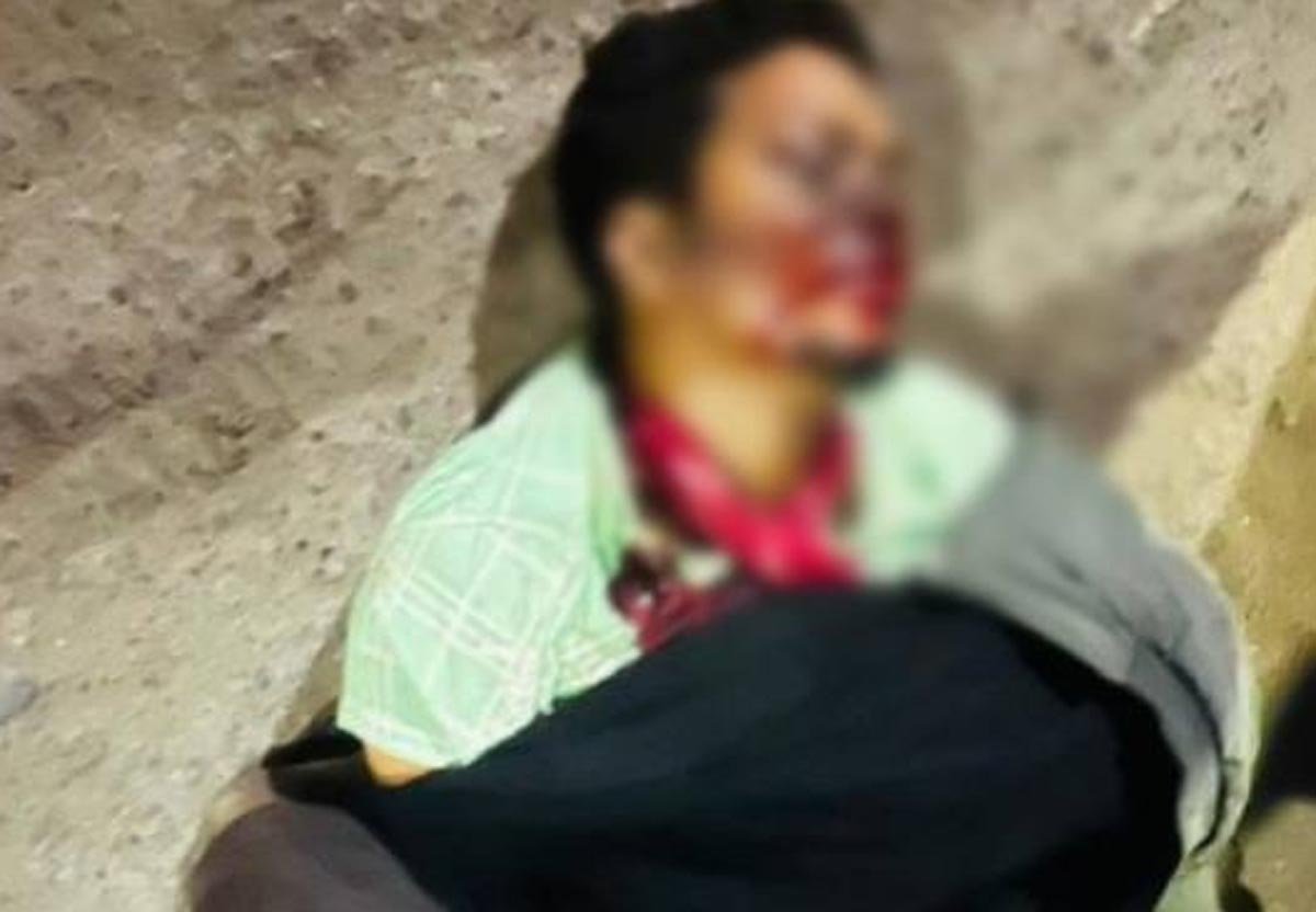 KORBA-ACCIDENT