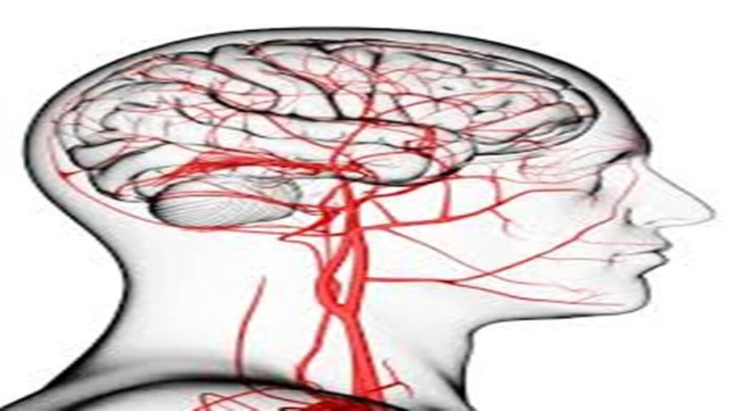 08_06_2024-brain_strok