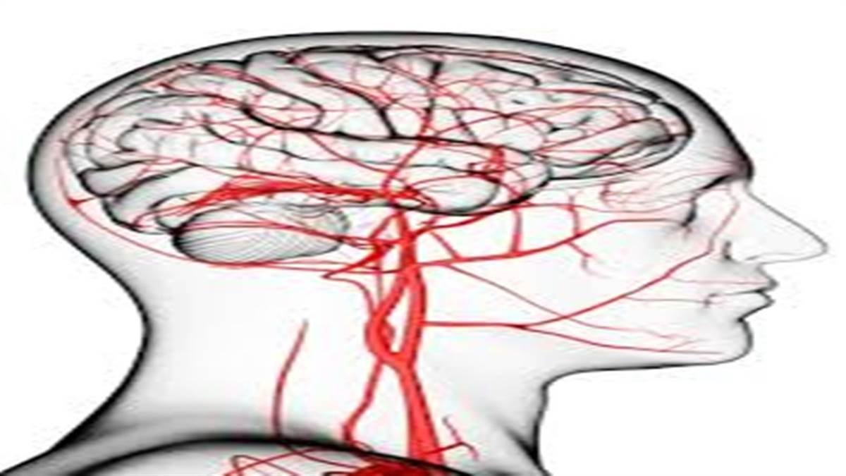 08_06_2024-brain_strok
