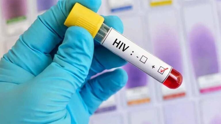 hiv.jpg