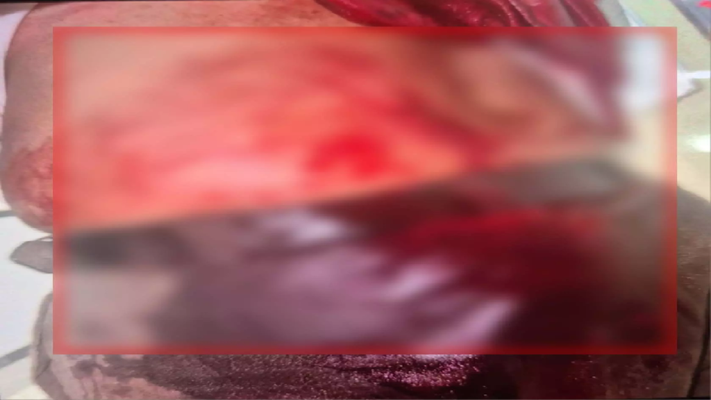 N