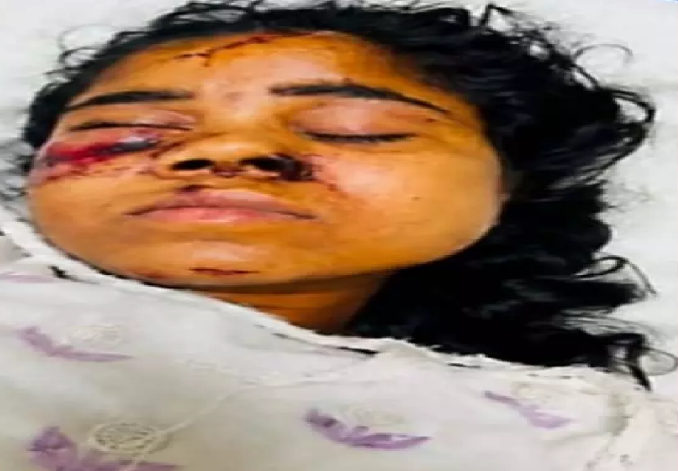 CG : रेल हादसे में घायल मुंगेली की युवती सिम्स में भर्ती, परिजनों की तलाश जारी