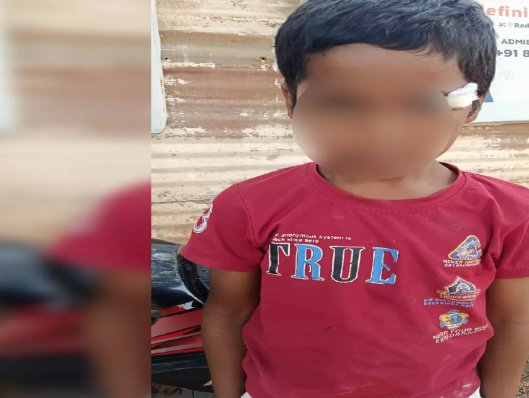 CG : माना के राय पब्लिक स्कूल में हादसा, क्लास में छात्र के ऊपर गिरा पंखा …