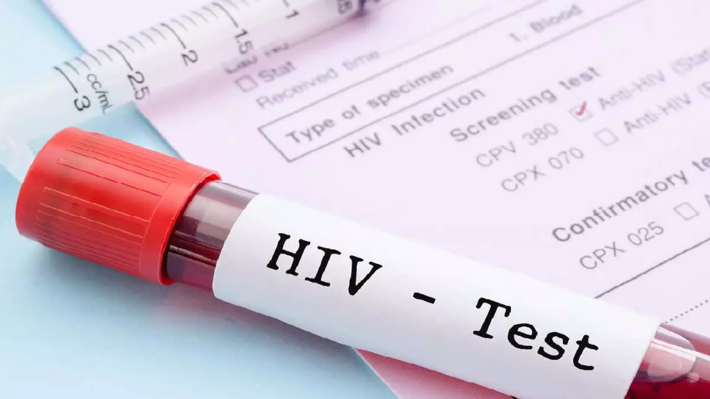 CG : नाम उजागर होने से HIV संक्रमितों में आक्रोश …
