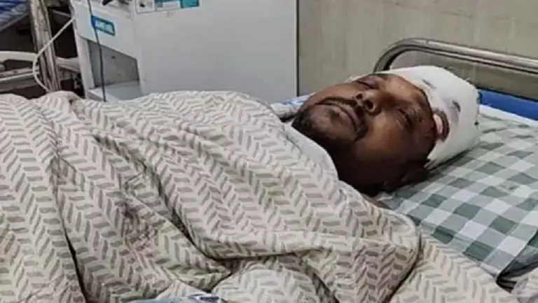CG : पार्षद पर जानलेवा हमला, झगड़ा छुड़ाने पहुंचे थे आरोपी ने सिर पर किया वार…