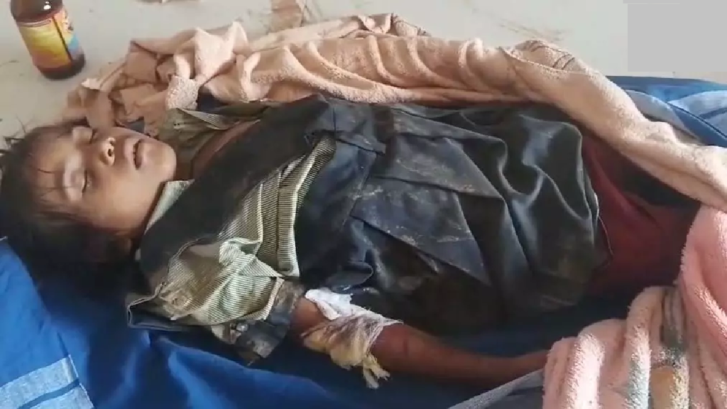 CG : स्कूल जाने निकली मासूम को स्कूल बस ने कुचला, मौत …