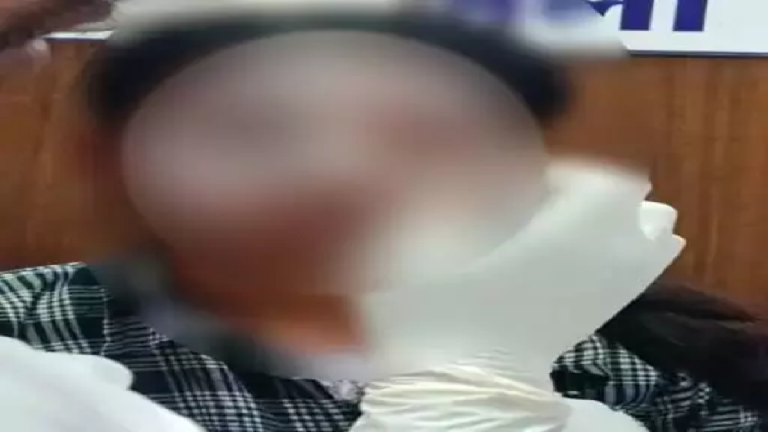 CG : लव प्रपोजल ठुकराने पर पुलिसकर्मी की बेटी पर एसिड अटैक, मुख्य आरोपी पुलिसकर्मी का बेटा अरेस्ट …