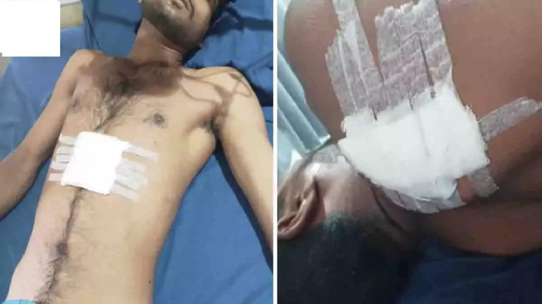CG : रायपुर में चाकूबाजों का हमला, युवक को 7 बार मारा चाकू; एक की हालत नाजुक …